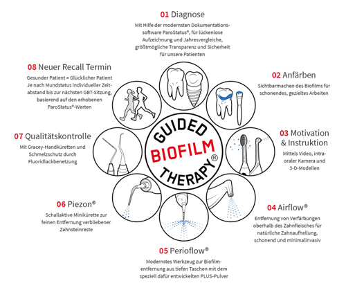 Guided Biofilm Therapy®